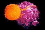 Cancro energia mitocondri sviluppo tumore