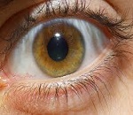 occhi maculopatia glaucoma