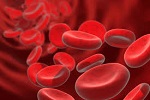 Malaria