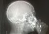 Donna esame radiografia cellulare