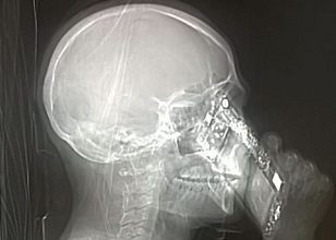 Donna esame radiografia cellulare