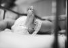 Bambina non ha otite ma raro cancro cervello