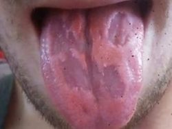 energy drink conseguenze abuso