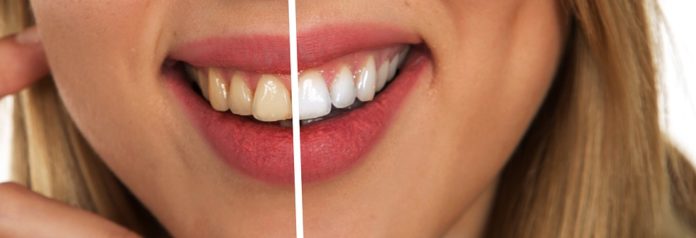 Denti prodotti sbiancanti
