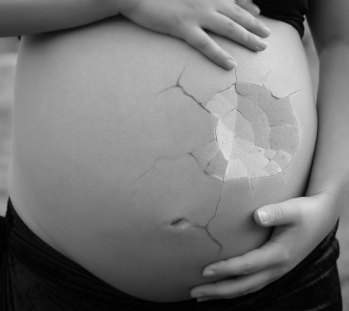 Aborto Alabama
