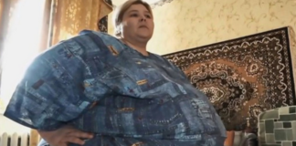 Donna tropo grasa vicini preoccupati