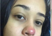 ragazza piercing paralizzata