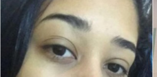 ragazza piercing paralizzata