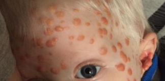 Bambino bolle
