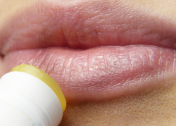 Herpes