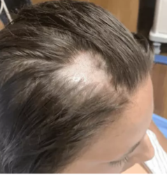 Ragazza balsamo crema depilatoria