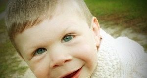 Sindrome di Williams